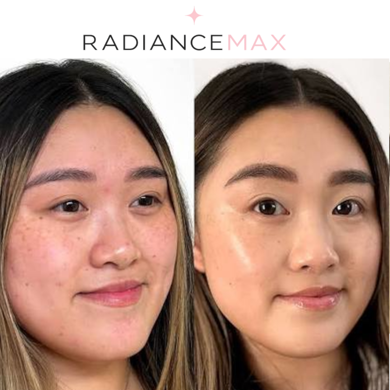 RadianceMax - PDRN Pink Collagen Capsule Cream