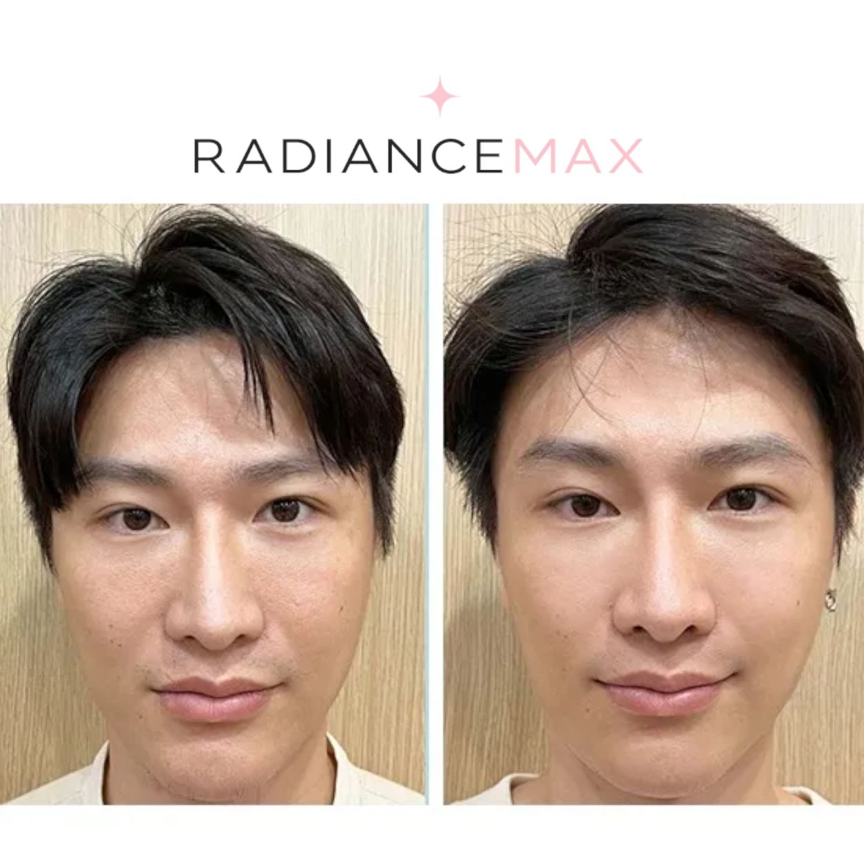 RadianceMax - PDRN Pink Collagen Capsule Cream