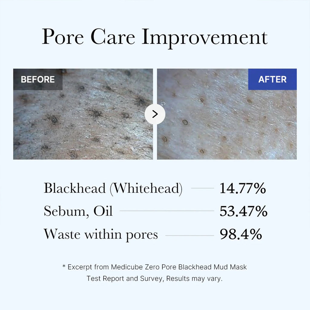 RadianceMax Zero Pore Blackhead Mud Mask