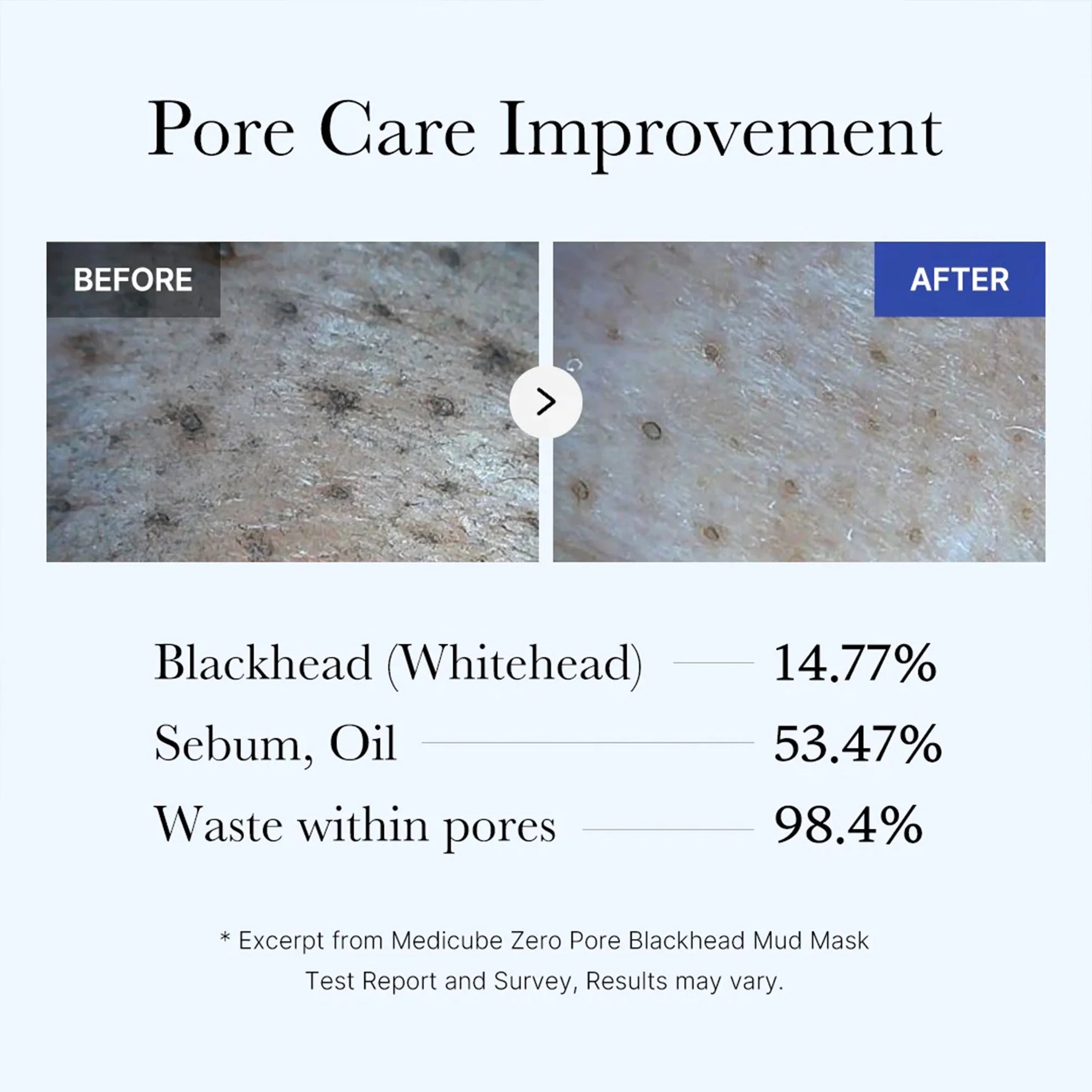 RadianceMax Zero Pore Blackhead Mud Mask