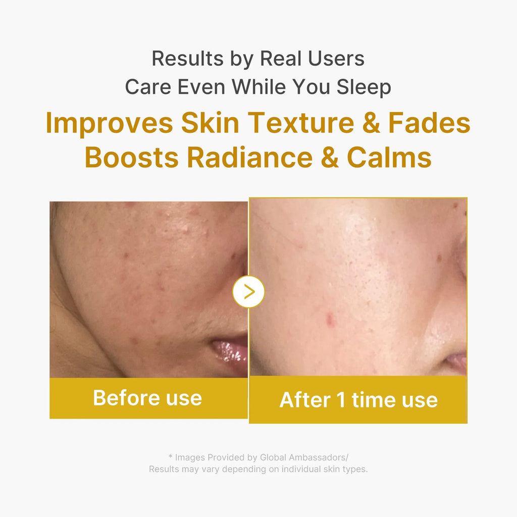 Radiancemax Kojic Acid Turmeric Overnight Wrapping Mask