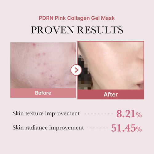 Radiance Max- Salmon PDRN Pink Collagen Jelly Gel Mask (4-Pack)